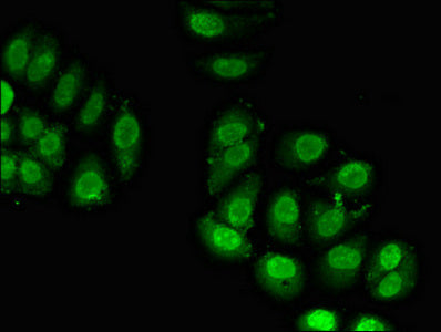 Immunofluorescent analysis of A549 cells using RPL23A Antibody at dilution of 1:100 and Alexa Fluor 488-congugated AffiniPure Goat Anti-Rabbit IgG(H+L)Rabbit anti-Human RPL23A Polyclonal Antibody