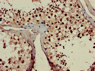 Immunohistochemistry of paraffin-embedded human testis tissue using RPL23A Antibody at dilution of 1:100Rabbit anti-Human RPL23A Polyclonal Antibody