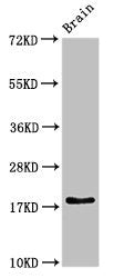 Western Blot | Positive WB detected in: Rat brain tissue | All lanes: RPL23A antibody at 3μg/ml | Secondary | Goat polyclonal to rabbit IgG at 1/50000 dilution | Predicted band size: 18 kDa | Observed band size: 18 kDaRabbit anti-Human RPL23A Polyclonal Antibody