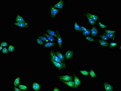 Immunofluorescent analysis of HepG2 cells using RPL28 Antibody at dilution of 1:100Rabbit anti-Human RPL28 Polyclonal Antibody