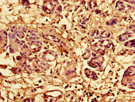 Immunohistochemistry of paraffin-embedded human pancreatic tissue using RPL28 Antibody at dilution of 1:100Rabbit anti-Human RPL28 Polyclonal Antibody