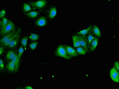 Immunofluorescent analysis of HepG2 cells using RPL4 Antibody at dilution of 1:100 and Alexa Fluor 488-congugated AffiniPure Goat Anti-Rabbit IgG(H+L)Rabbit anti-Human RPL4 Polyclonal Antibody