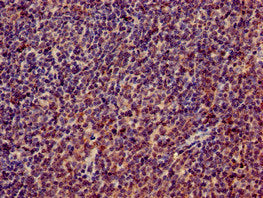 Immunohistochemistry of paraffin-embedded human lymph node tissue using RPL4 Antibody at dilution of 1:100Rabbit anti-Human RPL4 Polyclonal Antibody