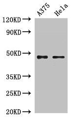 Western Blot  | Positive WB detected in: A375 whole cell lysate, Hela whole cell lysate  | All lanes: RPL4 antibody at 2µg/ml  | Secondary  | Goat polyclonal to rabbit IgG at 1/50000 dilution  | Predicted band size: 48 kDa  | Observed band size: 48 kDaRabbit anti-Human RPL4 Polyclonal Antibody
