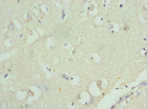 Immunohistochemistry of paraffin-embedded human brain tissue using RPL9 Antibody at dilution of 1:100Rabbit anti-Human RPL9 Polyclonal Antibody