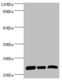 Western blot  | All lanes: RPL9 antibody at 0.61µg/ml  | Lane 1: SY-5Y whole cell lysate  | Lane 2: Hela whole cell lysate  | Lane 3: HepG2 whole cell lysate  | Secondary  | Goat polyclonal to rabbit IgG at 1/10000 dilution  | Predicted band size: 22 kDa  | Observed band size: 22 kDaRabbit anti-Human RPL9 Polyclonal Antibody