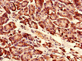 Immunocytochemistry analysis of human pancreatic tissue using RPLP0 Antibody at dilution of 1:100Rabbit anti-Human RPLP0 Polyclonal Antibody