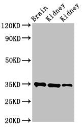 Western Blot  | Positive WB detected in: Rat brain tissue, Rat kidney tissue, Mouse kidney tissue  | All lanes: RPLP0 antibody at 3.4µg/ml  | Secondary  | Goat polyclonal to rabbit IgG at 1/50000 dilution  | Predicted band size: 35, 28 kDa  | Observed band size: 35 kDaRabbit anti-Human RPLP0 Polyclonal Antibody