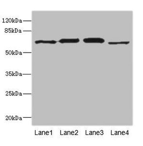 Western blot  | All lanes: RPN2 antibody at 1.91µg/ml  | Lane 1: NIH/3T3 whole cell lysate  | Lane 2: 293T whole cell lysate  | Lane 3: Hela whole cell lysate  | Lane 4: Human placenta tissue  | Secondary  | Goat polyclonal to rabbit IgG at 1/10000 dilution  | Predicted band size: 70, 68 kDa  | Observed band size: 70 kDaRabbit anti-Human RPN2 Polyclonal Antibody
