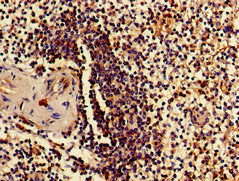 Immunohistochemistry of paraffin-embedded human spleen tissue using RPS15 Antibody at dilution of 1:100Rabbit anti-Human RPS15 Polyclonal Antibody