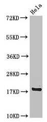 Western Blot  | Positive WB detected in: Hela whole cell lysate  | All lanes: RPS15 antibody at 4µg/ml  | Secondary  | Goat polyclonal to rabbit IgG at 1/50000 dilution  | Predicted band size: 18 kDa  | Observed band size: 18 kDaRabbit anti-Human RPS15 Polyclonal Antibody