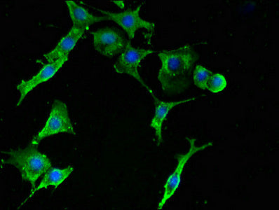 Immunofluorescent analysis of MCF-7 cells using RPS2 Antibody at dilution of 1:100 and Alexa Fluor 488-congugated AffiniPure Goat Anti-Rabbit IgG(H+L)Rabbit anti-Human RPS2 Polyclonal Antibody