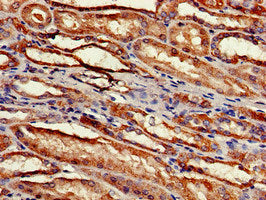 Immunohistochemistry of paraffin-embedded human kidney tissue using RPS2 Antibody at dilution of 1:100Rabbit anti-Human RPS2 Polyclonal Antibody