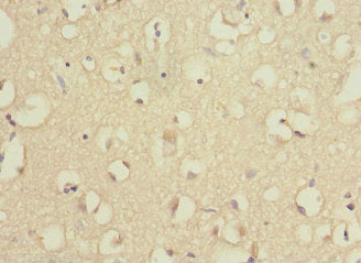 Immunohistochemistry of paraffin-embedded human brain tissue using RPS27 Antibody at dilution of 1:100Rabbit anti-Human RPS27 Polyclonal Antibody
