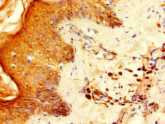 Immunohistochemistry of paraffin-embedded human skin tissue using RPS6 Antibody at dilution of 1:100Rabbit anti-Human RPS6 Polyclonal Antibody