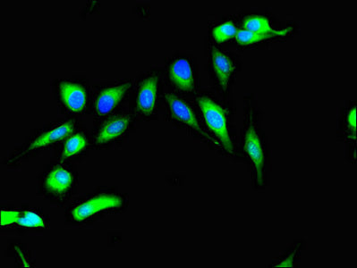 Immunofluorescent analysis of Hela cells using RPS6KA4 Antibody at dilution of 1:100 and Alexa Fluor 488-congugated AffiniPure Goat Anti-Rabbit IgG(H+L)Rabbit anti-Human RPS6KA4 Polyclonal Antibody