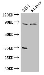 Western Blot  | Positive WB detected in: U251 whole cell lysate, Mouse kidney tissue  | All lanes: RPS6KA4 antibody at 3µg/ml  | Secondary  | Goat polyclonal to rabbit IgG at 1/50000 dilution  | Predicted band size: 86, 85 kDa  | Observed band size: 86 kDaRabbit anti-Human RPS6KA4 Polyclonal Antibody