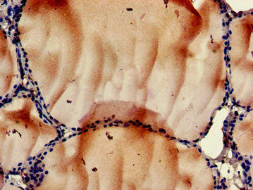 Immunohistochemistry of paraffin-embedded human thyroid tissue using RPS6KA5 Antibody at dilution of 1:100Rabbit anti-Human RPS6KA5 Polyclonal Antibody