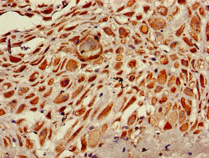 Immunohistochemistry of paraffin-embedded human placenta tissue using RPS6KA5 Antibody at dilution of 1:100Rabbit anti-Human RPS6KA5 Polyclonal Antibody