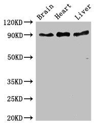 Western Blot | Positive WB detected in: Mouse brain tissue, Rat heart tissue, Rat liver tissue | All lanes: RPS6KA5 antibody at 3μg/ml | Secondary | Goat polyclonal to rabbit IgG at 1/50000 dilution | Predicted band size: 90, 62, 82 kDa | Observed band size: 90 kDaRabbit anti-Human RPS6KA5 Polyclonal Antibody