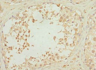 Immunohistochemistry of paraffin-embedded human testis tissue using RPS6KL1 Antibody at dilution of 1:100Rabbit anti-Human RPS6KL1 Polyclonal Antibody