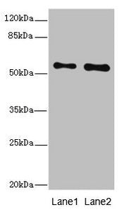 Western blot | All lanes: RPS6KL1 antibody at 4.02μg/ml | Lane 1: Mouse heart tissue | Lane 2: Mouse kidney tissue | Secondary | Goat polyclonal to rabbit IgG at 1/10000 dilution | Predicted band size: 61, 60, 29 kDa | Observed band size: 61 kDaRabbit anti-Human RPS6KL1 Polyclonal Antibody