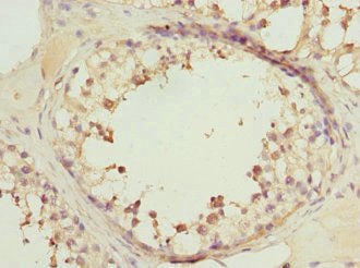 Immunohistochemistry of paraffin-embedded human testis tissue using RRAS2 Antibody at dilution of 1:100Rabbit anti-Human RRAS2 Polyclonal Antibody