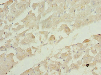 Immunohistochemistry of paraffin-embedded human heart tissue using RRAS2 Antibody at dilution of 1:100Rabbit anti-Human RRAS2 Polyclonal Antibody