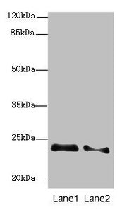 Western blot  | All lanes: RRAS2 antibody at 2.66µg/ml  | Lane 1: NIH/3T3 whole cell lysate  | Lane 2: A431 whole cell lysate  | Secondary  | Goat polyclonal to rabbit IgG at 1/10000 dilution  | Predicted band size: 24, 16, 20, 25 kDa  | Observed band size: 24 kDaRabbit anti-Human RRAS2 Polyclonal Antibody