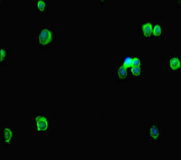 Immunofluorescent analysis of HepG2 cells using RTEL1 Antibody at dilution of 1:100 and Alexa Fluor 488-congugated AffiniPure Goat Anti-Rabbit IgG(H+L)Rabbit anti-Human RTEL1 Polyclonal Antibody