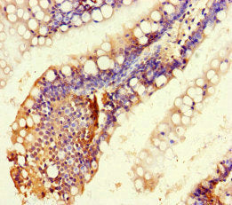 Immunohistochemistry of paraffin-embedded human small intestine tissue using the antibody at dilution of 1:100Rabbit anti-Human RTEL1 Polyclonal Antibody