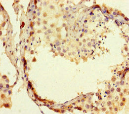 Immunohistochemistry of paraffin-embedded human testis tissue using RTEL1 Antibody at dilution of 1:100Rabbit anti-Human RTEL1 Polyclonal Antibody