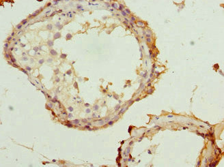 Immunohistochemistry of paraffin-embedded human testis tissue using RTKN Antibody at dilution of 1:100Rabbit anti-Human RTKN Polyclonal Antibody