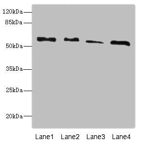 Western blot | All lanes: RTKN antibody at 4.66μg/ml | Lane 1: A431 whole cell lysate | Lane 2: HepG2 whole cell lysate | Lane 3: MCF-7 whole cell lysate | Lane 4: Mouse brain tissue | Secondary | Goat polyclonal to rabbit IgG at 1/10000 dilution | Predicted band size: 63, 62, 57 kDa | Observed band size: 63 kDaRabbit anti-Human RTKN Polyclonal Antibody