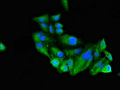 Immunofluorescent analysis of Hela cells using RUNX3 Antibody at dilution of 1:100 and Alexa Fluor 488-congugated AffiniPure Goat Anti-Rabbit IgG(H+L)Rabbit anti-Human RUNX3 Polyclonal Antibody