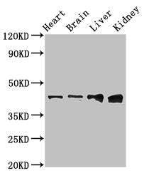 Western Blot | Positive WB detected in: Rat heart tissue, Mouse brain tissue, Mouse liver tissue, Mouse kidney tissue | All lanes: RUNX3 antibody at 3μg/ml | Secondary | Goat polyclonal to rabbit IgG at 1/50000 dilution | Predicted band size: 45, 46 kDa | Observed band size: 45 kDaRabbit anti-Human RUNX3 Polyclonal Antibody