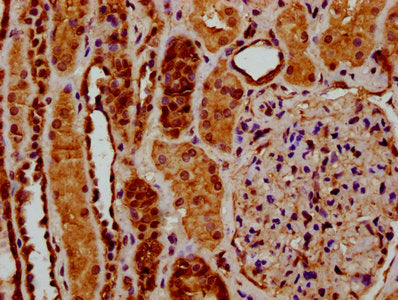 IHC image of RYK Antibody diluted at 1:200 and staining in paraffin-embedded human kidney tissue performed on a Leica BondTM system. After dewaxing and hydration, antigen retrieval was mediated by high pressure in a citrate buffer (pH 6.0). Section was blocked with 10% normal goat serum 30min at RT. Then primary antibody (1% BSA) was incubated at 4°C overnight. The primary is detected by a biotinylated secondary antibody and visualized using an HRP conjugated SP system.Rabbit anti-Human RYK Polyclonal Antibody