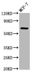 Western Blot | Positive WB detected in: MCF-7 whole cell lysate | All lanes: RYK antibody at 3.3μg/ml | Secondary | Goat polyclonal to rabbit IgG at 1/50000 dilution | Predicted band size: 68 kDa | Observed band size: 68 kDaRabbit anti-Human RYK Polyclonal Antibody
