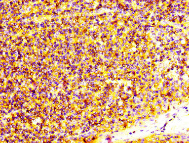 IHC image of S100A4 Antibody diluted at 1:600 and staining in paraffin-embedded human tonsil tissue performed on a Leica BondTM system. After dewaxing and hydration, antigen retrieval was mediated by high pressure in a citrate buffer (pH 6.0). Section was blocked with 10% normal goat serum 30min at RT. Then primary antibody (1% BSA) was incubated at 4°C overnight. The primary is detected by a biotinylated secondary antibody and visualized using an HRP conjugated SP system.Rabbit anti-Human S100A4 Polyclonal Antibody