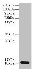 Western blot  | All lanes: S100A4 antibody at 2µg/ml + A549 whole cell lysate  | Secondary  | Goat polyclonal to rabbit IgG at 1/10000 dilution  | Predicted band size: 12 kDa  | Observed band size: 12 kDaRabbit anti-Human S100A4 Polyclonal Antibody