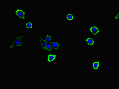 Immunofluorescent analysis of HepG2 cells using S100G Antibody at dilution of 1:100 and Alexa Fluor 488-congugated AffiniPure Goat Anti-Rabbit IgG(H+L)Rabbit anti-Human S100G Polyclonal Antibody