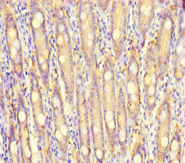 Immunohistochemistry of paraffin-embedded human small intestine tissue using the antibody at dilution of 1:100Rabbit anti-Human S100G Polyclonal Antibody