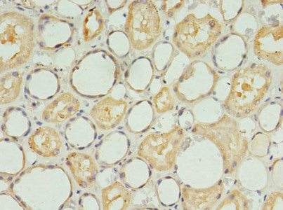 Immunohistochemistry of paraffin-embedded human kidney tissue using S1PR1 Antibody at dilution of 1:100Rabbit anti-Human S1PR1 Polyclonal Antibody