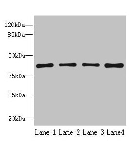 Western blot  | All lanes: S1PR1 antibody at 2µg/ml  | Lane 1: Jurkat whole cell lysate  | Lane 2: A375 whole cell lysate  | Lane 3: Mouse thymus tissue  | Lane 4: HepG2 whole cell lysate  | Secondary  | Goat polyclonal to rabbit IgG at 1/10000 dilution  | Predicted band size: 43 kDa  | Observed band size: 43 kDaRabbit anti-Human S1PR1 Polyclonal Antibody