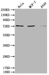 Western Blot | Positive WB detected in: Hela whole cell lysate, MCF-7 whole cell lysate, A549 whole cell lysate | All lanes: SAMHD1 antibody at 1:2000 | Secondary | Goat polyclonal to rabbit IgG at 1/50000 dilution | Predicted band size: 73, 64, 69 kDa | Observed band size: 73 kDaRabbit anti-Human SAMHD1 Polyclonal Antibody