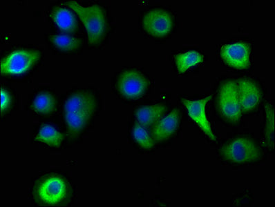 Immunofluorescence staining of A549 cells with SBK2 Antibody at 1:50, counter-stained with DAPI. The cells were fixed in 4% formaldehyde, permeabilized using 0.2% Triton X-100 and blocked in 10% normal Goat Serum. The cells were then incubated with the antibody overnight at 4°C. The secondary antibody was Alexa Fluor 488-congugated AffiniPure Goat Anti-Rabbit IgG(H+L).Rabbit anti-Human SBK2 Polyclonal Antibody