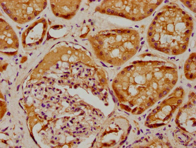 IHC image of the antibody diluted at 1:100 and staining in paraffin-embedded human kidney tissue performed on a Leica BondTM system. After dewaxing and hydration, antigen retrieval was mediated by high pressure in a citrate buffer (pH 6.0). Section was blocked with 10% normal goat serum 30min at RT. Then primary antibody (1% BSA) was incubated at 4°C overnight. The primary is detected by a biotinylated secondary antibody and visualized using an HRP conjugated SP system.Rabbit anti-Human SBK2 Polyclonal Antibody