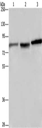Gel: 8%SDS-PAGE, Lysate: 40 μg, Lane 1-3: Mouse brain tissue, A172 cells, Hela cells, Primary antibody: DBH Antibody(DBH Antibody) at dilution 1/200, Secondary antibody: Goat anti rabbit IgG at 1/8000 dilution, Exposure time: 10 secondsRabbit anti-Human DBH Polyclonal Antibody