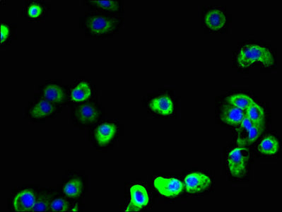 Immunofluorescent analysis of A431 cells using the antibody at dilution of 1:100 and Alexa Fluor 488-congugated AffiniPure Goat Anti-Rabbit IgG(H+L)Rabbit anti-Human SCAMP2 Polyclonal Antibody