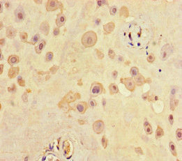 Immunohistochemistry of paraffin-embedded human placenta tissue using the antibody at dilution of 1:100Rabbit anti-Human SCG2 Polyclonal Antibody